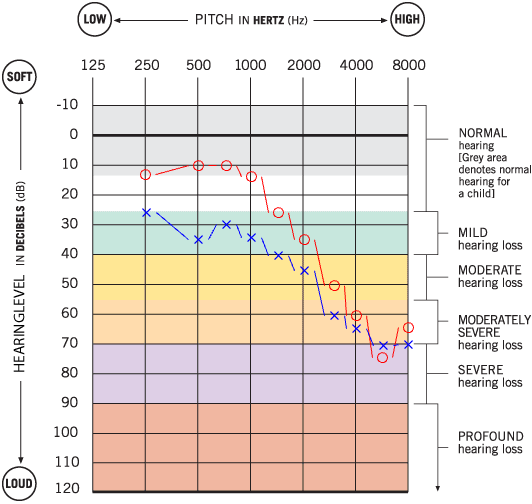 Managing-Age-Related-Hearing-Loss-A-Case-Study-of-Mrs.-Hine-LINNER Linner