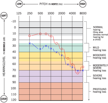 Managing-Age-Related-Hearing-Loss-A-Case-Study-of-Mrs.-Hine-LINNER Linner