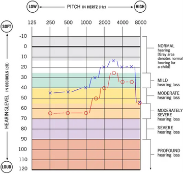 Managing-Low-Frequency-Hearing-Loss-in-an-Elderly-Patient-A-Case-Study-of-Ms.-Jarvis-Hearing-Aid-Journey Linner